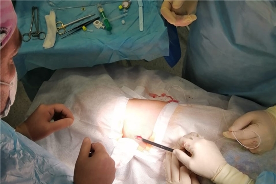 Специалисты Республиканской детской клинической больницы впервые установили эпидуральную порт-систему тяжело больному ребенку