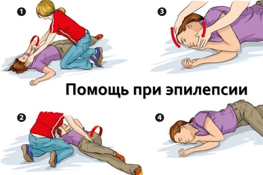 Эпилепсия: что нужно и чего нельзя делать, если у кого-то случился приступ?