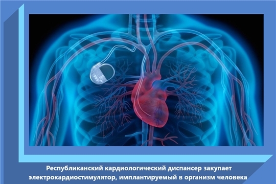 Республиканский кардиологический диспансер закупает электрокардиостимулятор, имплантируемый в организм человека