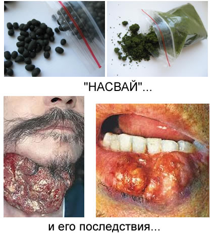 Молодежь, берегите свое здоровье! Откажитесь от наркозависимости
