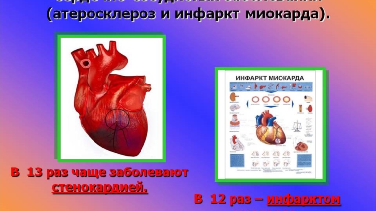 Курение – фактор риска сердечно-сосудистых заболеваний