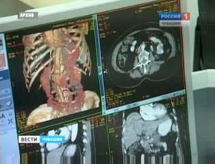 Во всемирный день борьбы против рака в Чебоксарах пройдет донорская акция