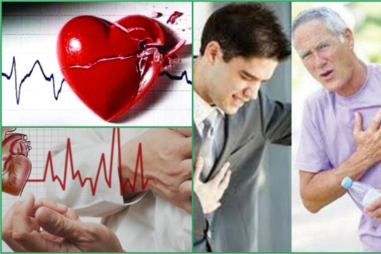 Инфаркт миокарда: что нужно сделать до приезда «скорой»