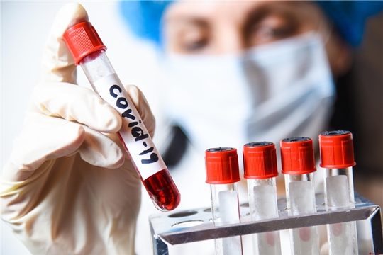 В поликлинике Алатырской ЦРБ организовано добровольное тестирование на коронавирусную инфекцию