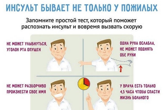 Инсульт: каждая минута на счету