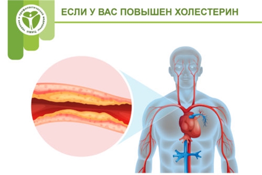 Повышенный холестерин - симптомы, причины и лечение в СПб